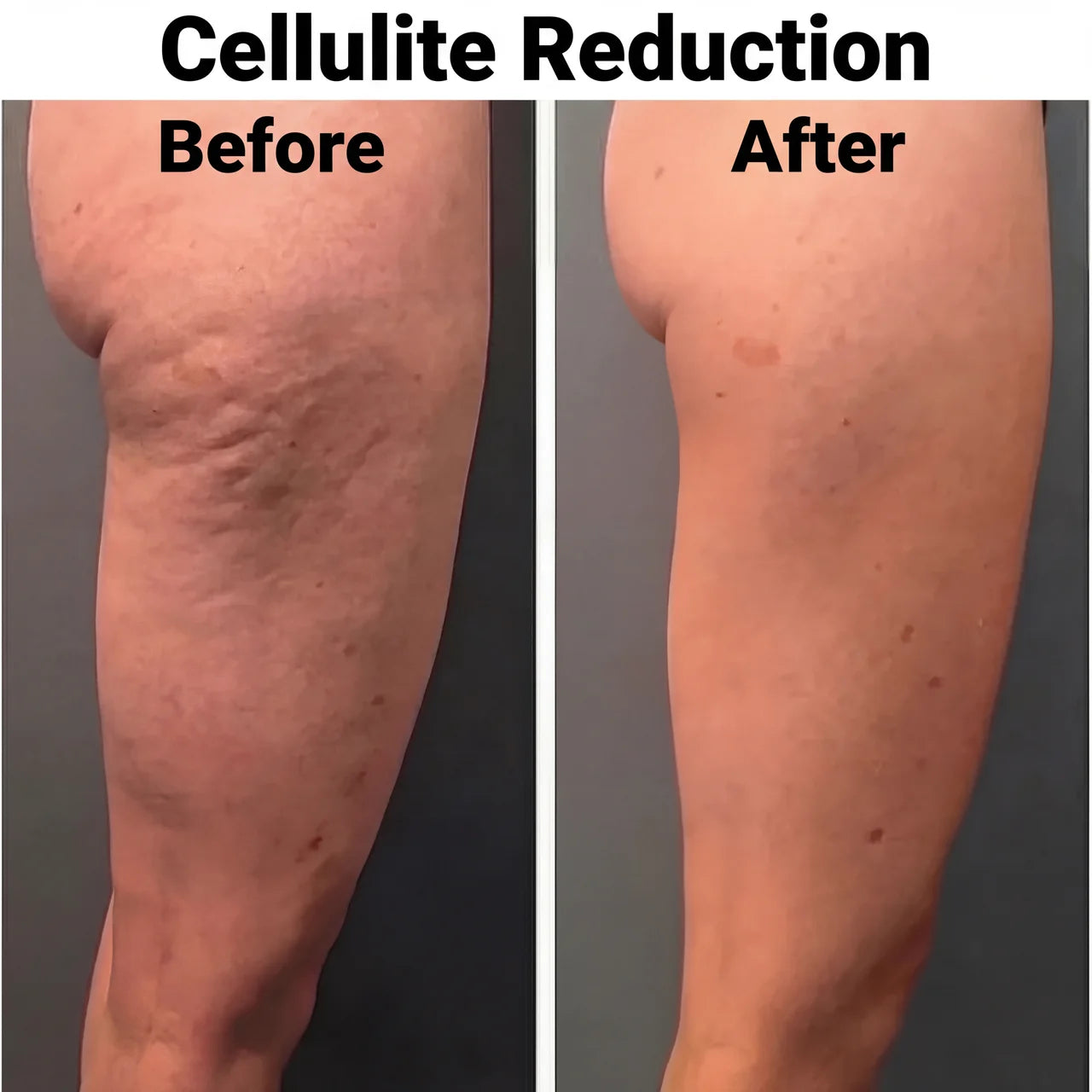 Drainelle™ — The Drainage That Changes Everything